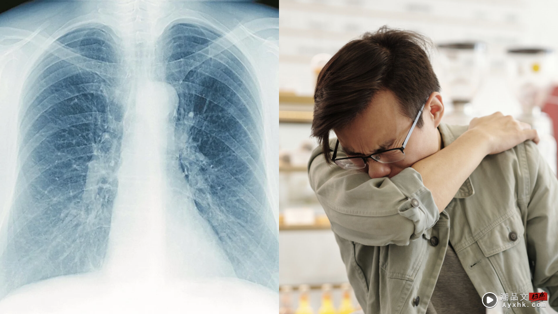 相关信息 | 肺痨的 9大症状！持续咳嗽、咳痰超过2周要注意 这5种人是高风险群 更多热点 图2张